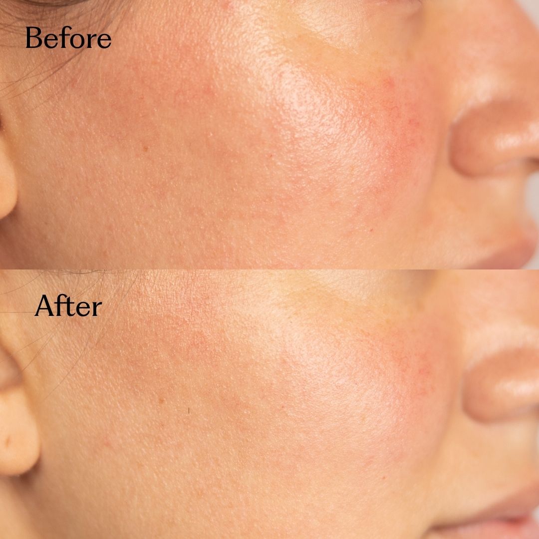 Restore firmness & glow