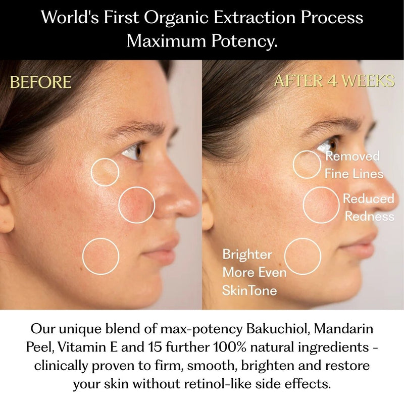 MOISTURISER - Retinol Alternative